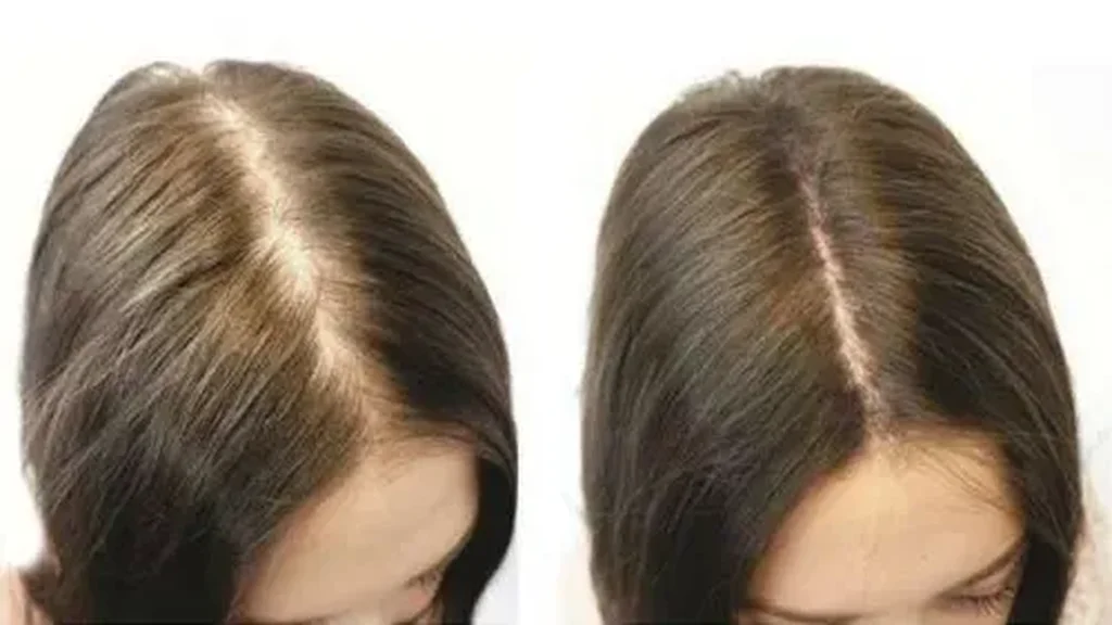 Hair extension - recenzii - in farmacii - cumpără - preț - compoziție - România - ce este - pareri - comentarii