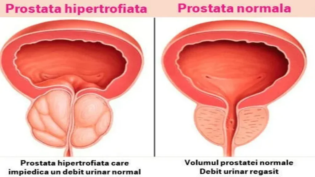 presyo - opisyal na site - saan bibili - parmasya